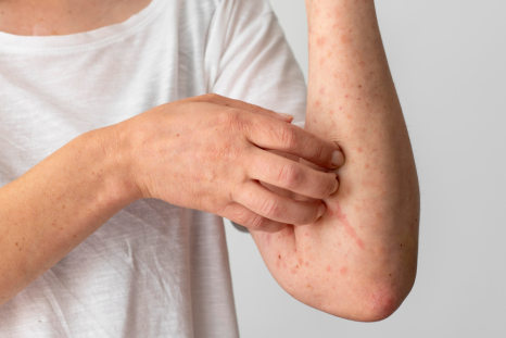 Persistent itching can have many causes, from dry skin and allergies to underlying medical conditions. Experts explain why ongoing itchiness without a rash should not be ignored.
