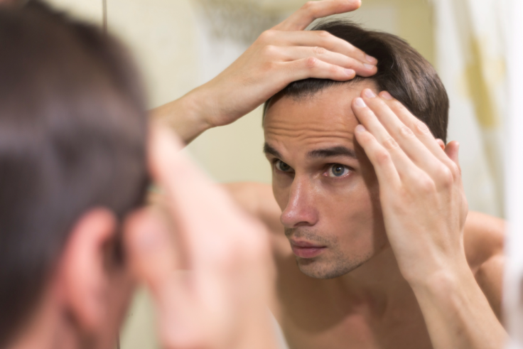 Alopecia / Hair Loss