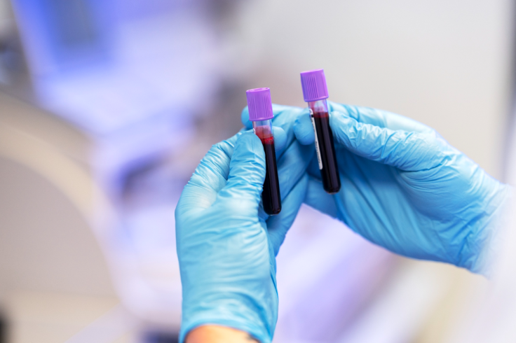 Blood Samples