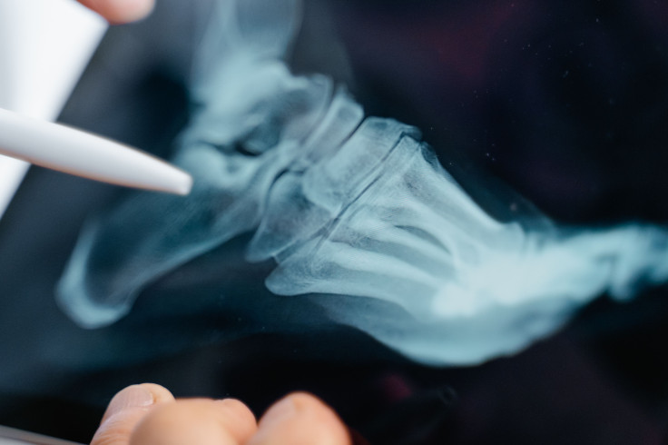 Radiography screening policy sparks debate.