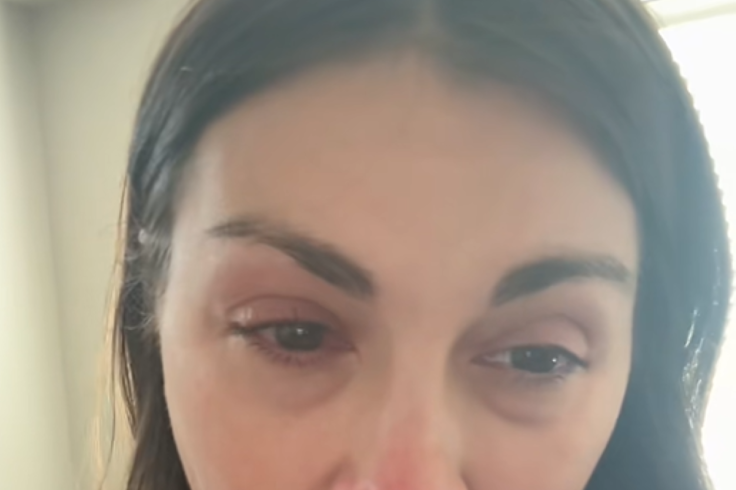 painful eye condition
