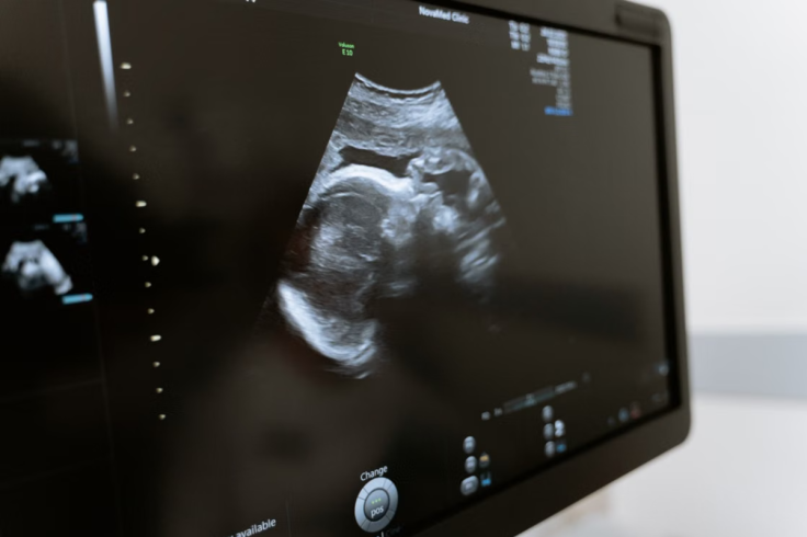 Ultrasound Scan During Pregnancy