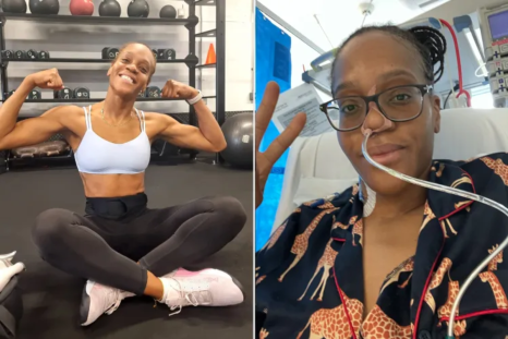 Kara Miller before and after cancer.