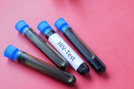 Fiji declares National HIV Emergency after one in 60 adults estimated to have the virus