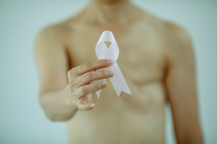 62-year-old find male breast cancer lump