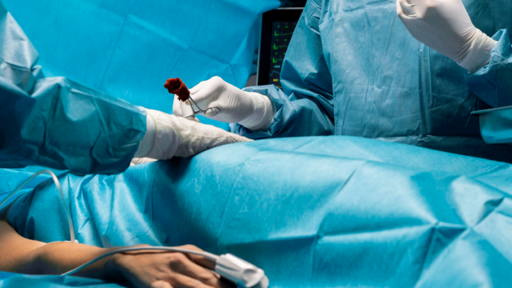 mastectomy